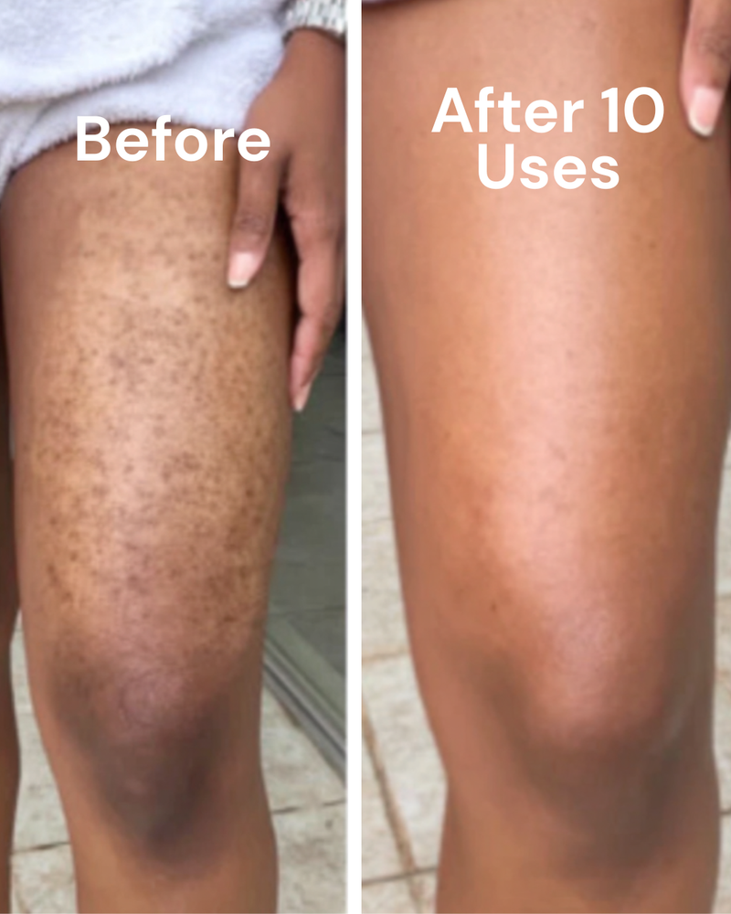 Before and after — Waxing PIH
