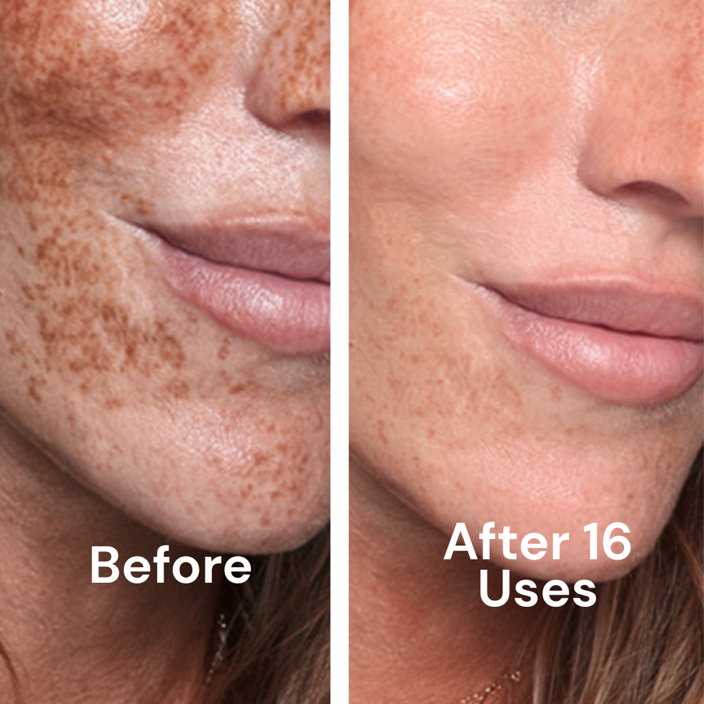 Tone Brightening Booster for Hyperpigmentation