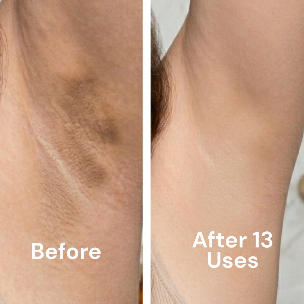 Tone Brightening Booster for Hyperpigmentation
