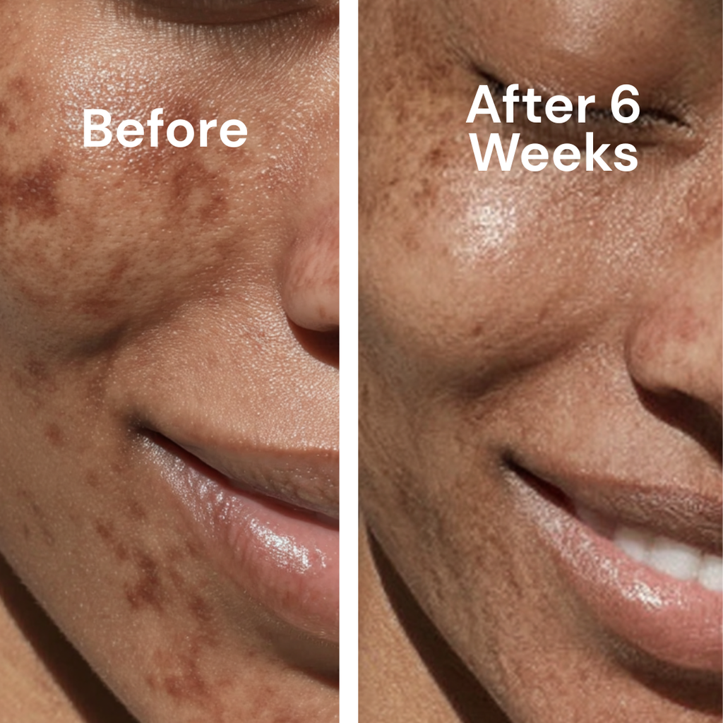 Tone Brightening Booster for Hyperpigmentation