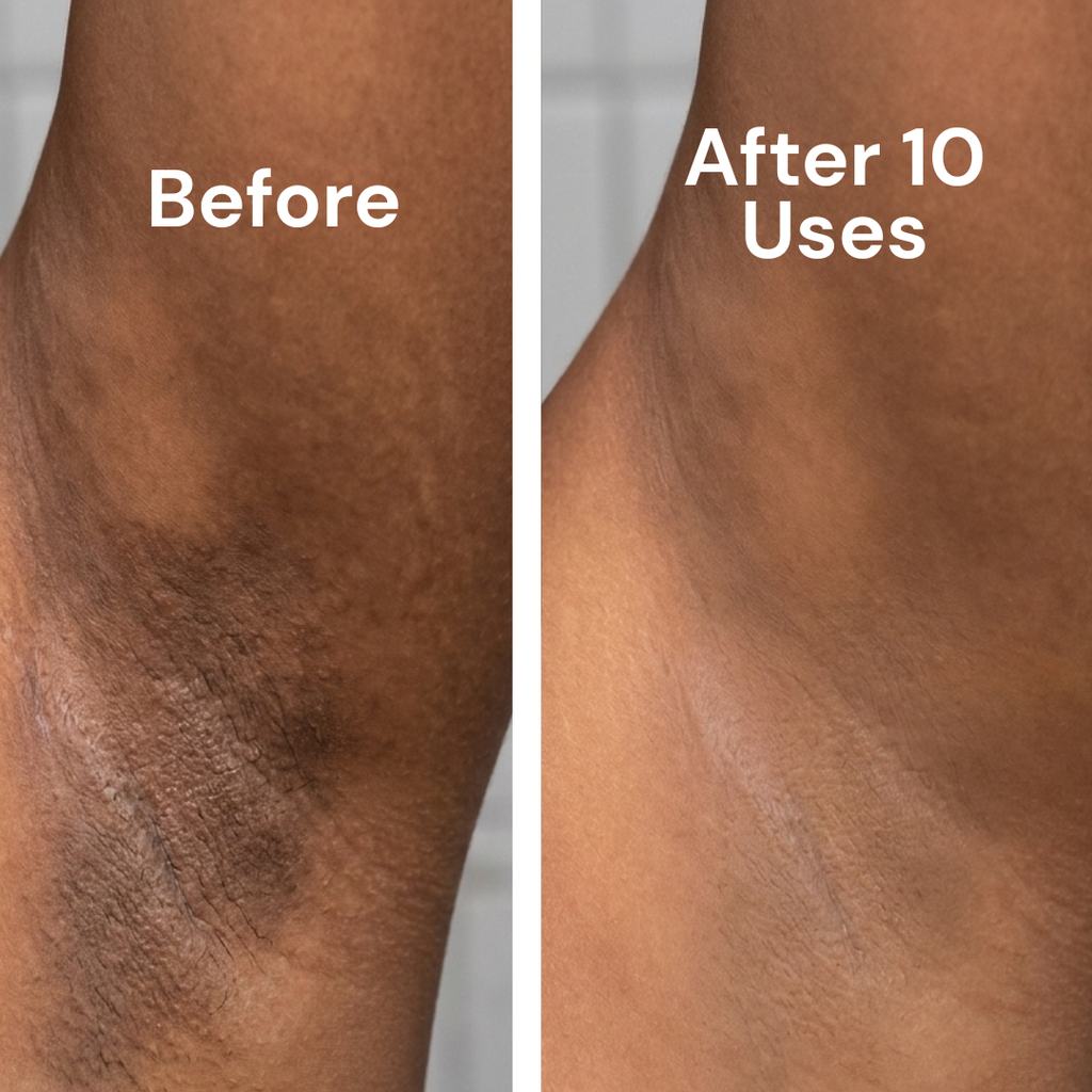 Tone Brightening Booster for Hyperpigmentation